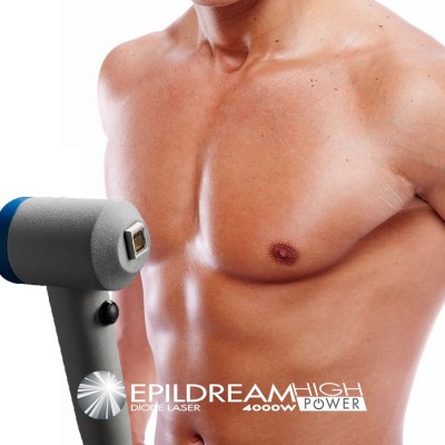 Epildream Diodo Laser Epilazione Area Large 