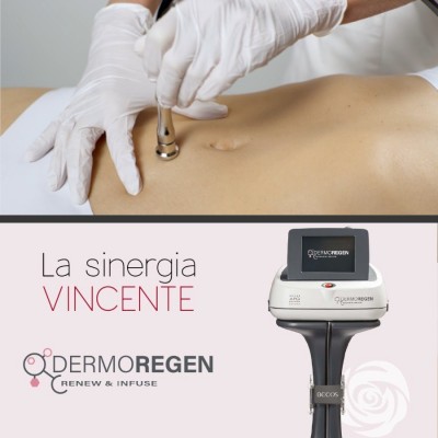 Dermoregen Corpo -microdermoabrasione Vacuum -8 Tratamenti 