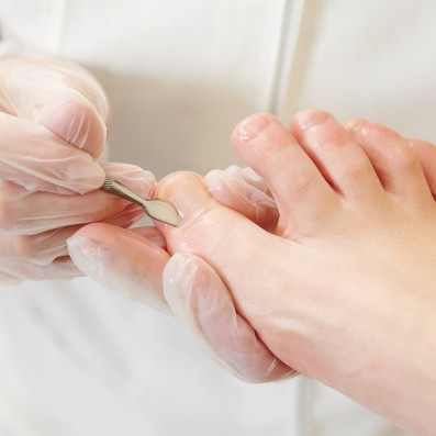 Pedicure Curativo-Estetico 